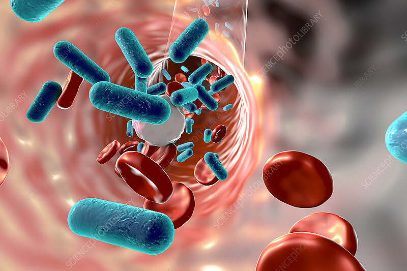 Laura Pučeta: sepsis and septic shock are life threatening syndromes 